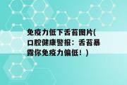 免疫力低下舌苔图片(口腔健康警报：舌苔暴露你免疫力偏低！)