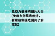 免疫力低痤疮图片大全(免疫力低易患痤疮，看看这些痤疮图片了解症状)